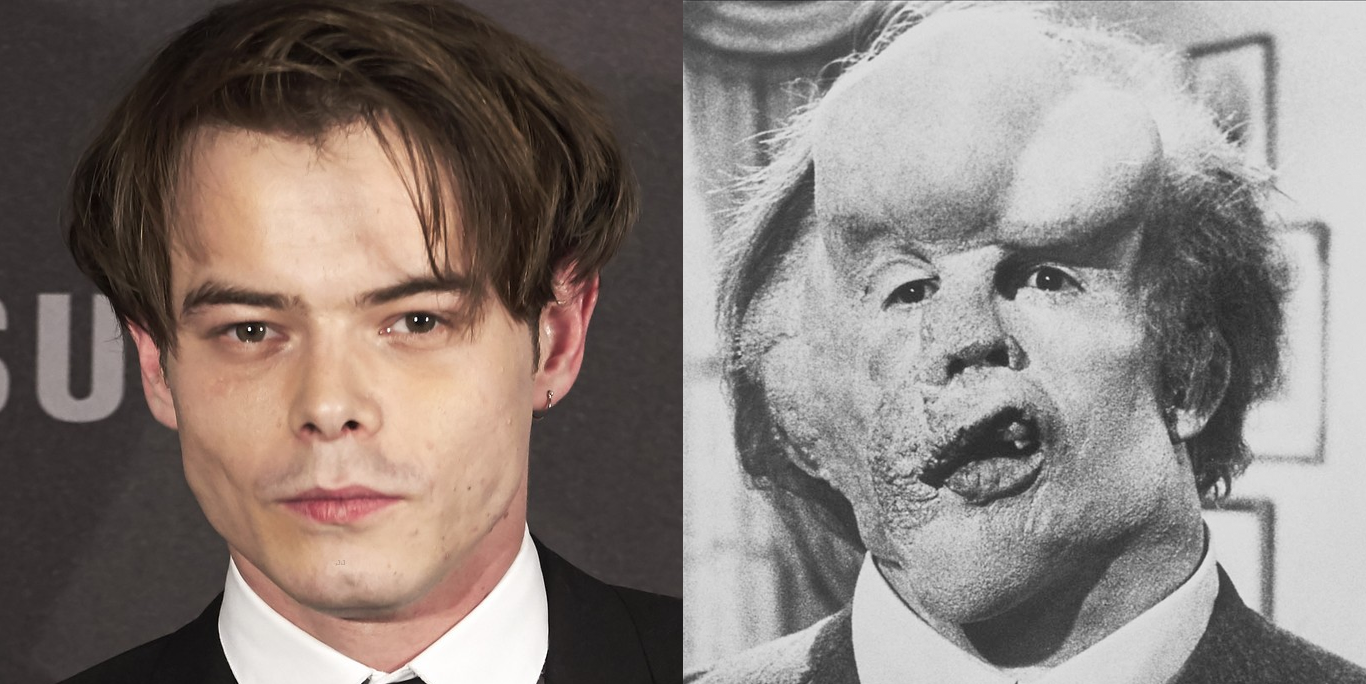 Charlie Heaton es criticado por ser seleccionado para interpretar a El Hombre Elefante sin tener alguna discapacidad